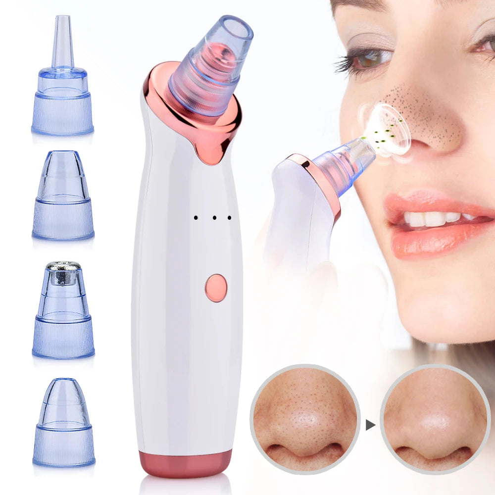 Electric Suction Blackhead Remover
