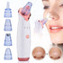 Electric Suction Blackhead Remover